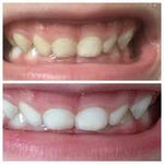 Whitening Toothpaste