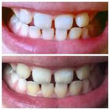 Whitening Toothpaste