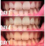 Whitening Toothpaste