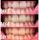 Whitening Toothpaste