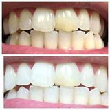 Whitening Toothpaste